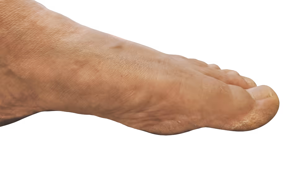 Procedure
